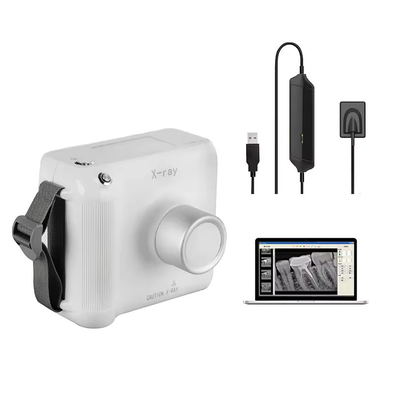 Portable Dental X-Ray Unit with RVG Sensor for Digital Imaging